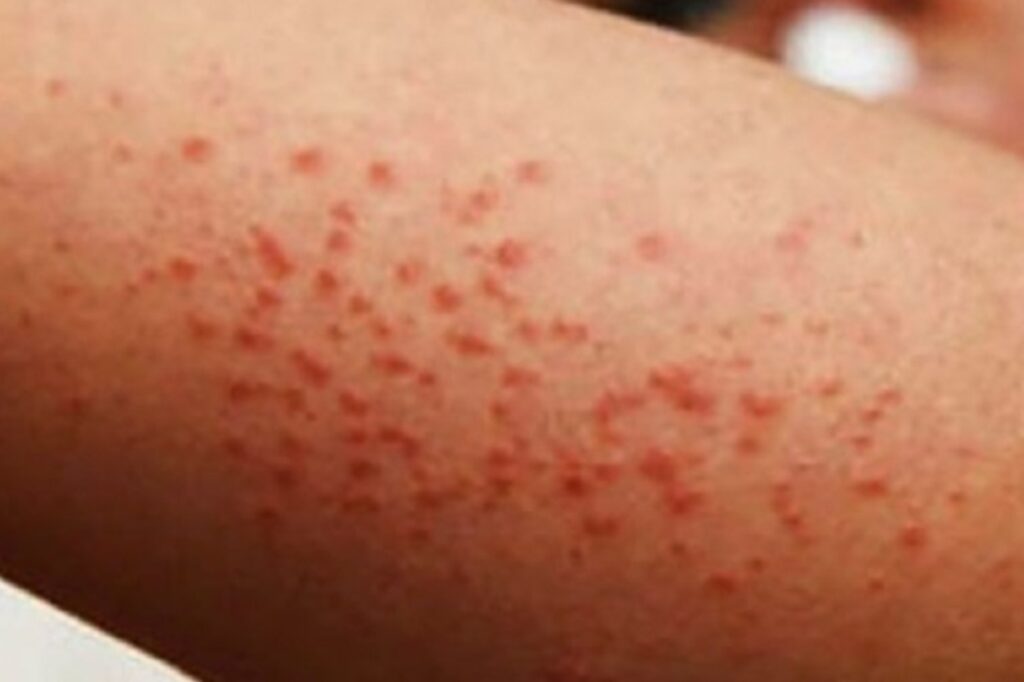 WhatsApp Image 2025-11-19 at 10.34.13