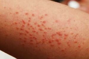 WhatsApp Image 2025-11-19 at 10.34.13