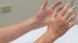 WhatsApp Image 2026-03-04 at 09.08.48